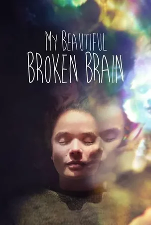 My Beautiful Broken Brain 2014 Full HD Türkçe Dublaj Film İzle